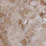 C7orf72 Antibody in Immunohistochemistry (Paraffin) (IHC (P))