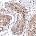 C7orf72 Antibody in Immunohistochemistry (Paraffin) (IHC (P))