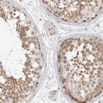 C8orf48 Antibody in Immunohistochemistry (Paraffin) (IHC (P))