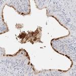 MUC15 Polyclonal Antibody