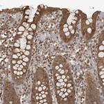 DNAJC8 Polyclonal Antibody