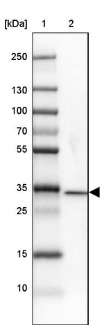 DNAJC8 Antibody in Western Blot (WB)