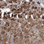 RAB29 Polyclonal Antibody