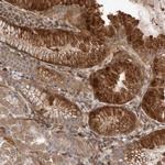 PEAK1 Polyclonal Antibody