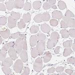 GSDMC Antibody in Immunohistochemistry (Paraffin) (IHC (P))