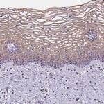 GSDMC Antibody in Immunohistochemistry (IHC)
