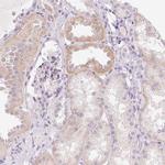 GSDMC Antibody in Immunohistochemistry (IHC)
