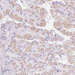 GSDMC Antibody in Immunohistochemistry (IHC)