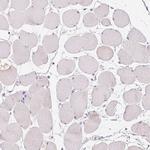 GSDMC Antibody in Immunohistochemistry (IHC)