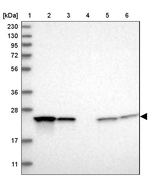 PSMB2 Antibody in Western Blot (WB)