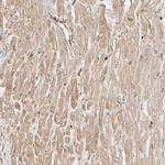 ARHGEF10L Antibody in Immunohistochemistry (Paraffin) (IHC (P))