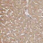 ARHGEF10L Antibody in Immunohistochemistry (Paraffin) (IHC (P))