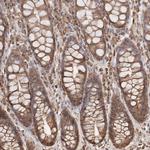 ARHGEF10L Antibody in Immunohistochemistry (Paraffin) (IHC (P))