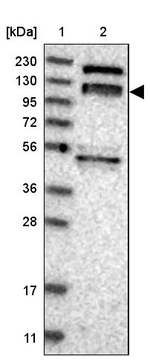 ARHGEF10L Antibody in Western Blot (WB)