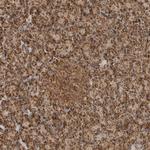 BIKE Polyclonal Antibody