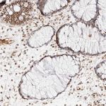 ZBED6 Polyclonal Antibody