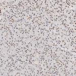 ZBED6 Antibody in Immunohistochemistry (Paraffin) (IHC (P))