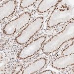 ZBED6 Antibody in Immunohistochemistry (Paraffin) (IHC (P))