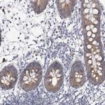 AGMAT Antibody in Immunohistochemistry (IHC)