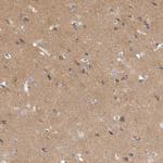 SAPAP3 Antibody in Immunohistochemistry (IHC)