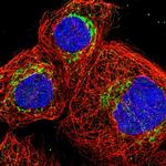 DBT Polyclonal Antibody