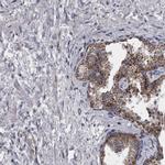 DBT Antibody in Immunohistochemistry (IHC)
