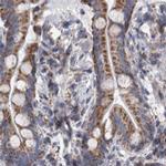 DBT Antibody in Immunohistochemistry (IHC)
