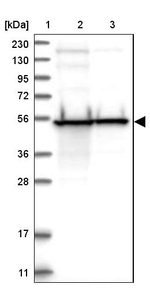 DBT Antibody in Western Blot (WB)
