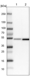 DBT Antibody in Western Blot (WB)