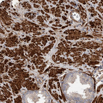 EPRS Polyclonal Antibody