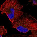 FAM82B Polyclonal Antibody