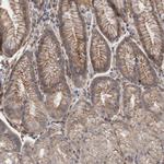 FAM82B Antibody in Immunohistochemistry (IHC)