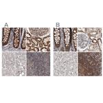 AspRS Polyclonal Antibody