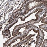 FSBP Polyclonal Antibody