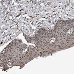 FSBP Antibody in Immunohistochemistry (Paraffin) (IHC (P))