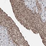 FSBP Antibody in Immunohistochemistry (Paraffin) (IHC (P))