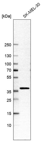 FSBP Antibody in Western Blot (WB)