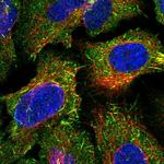 CAMSAP2 Polyclonal Antibody