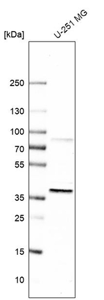 EBNA1BP2 Antibody in Western Blot (WB)