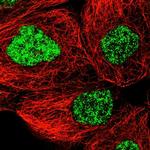 SNRNP40 Antibody in Immunocytochemistry (ICC/IF)