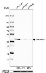 SNRNP40 Antibody