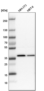 SNRNP40 Antibody in Western Blot (WB)