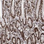 SNRNP40 Antibody in Immunohistochemistry (IHC)
