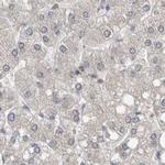 AspRS Antibody in Immunohistochemistry (IHC)