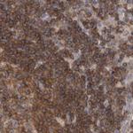 AspRS Antibody in Immunohistochemistry (IHC)