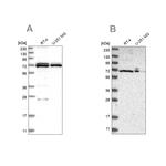 AspRS Antibody in Western Blot (WB)