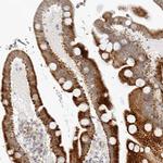 RPS6KC1 Antibody in Immunohistochemistry (IHC)