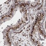 C17orf70 Polyclonal Antibody