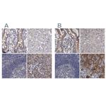 DBT Polyclonal Antibody