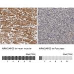 PARG1 Antibody in Immunohistochemistry (IHC)